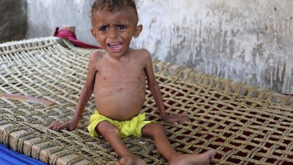 A malnourished Yemeni boy sits on a wooden bench on 26 September 2016. (AFP)