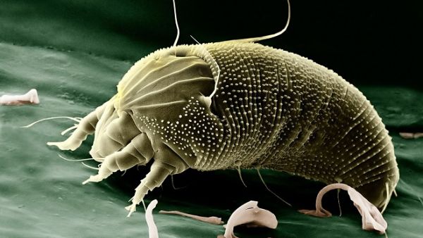 Just a gram (about half a teaspoon) of the fine dust found in AC vents can contain up to 1,000 dust mites. Yuk. (Pixabay)