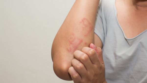 يجب الابتعاد عن الأطعمة التي تحتوي على نسبة عالية من الأملاح في رمضان