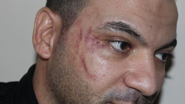 العامل المصري المعتدى عليه