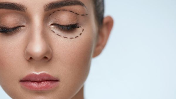 مشكلة الهالات السوداء قد تكون مرضية  مشكلة الهالات السوداء قد تكون مرضية