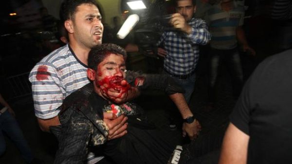 جريح في مستشفى الشفاء بمدينة غزة/أ.ف.ب