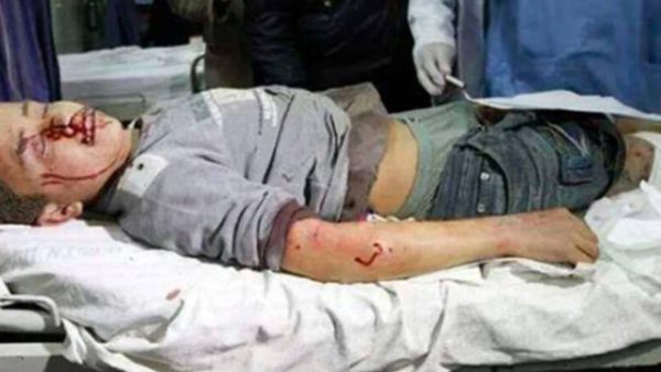 مئات الشهداء وآلاف الجرحى جراء العدوان الإسرائيلي المتواصل على قطاع غزة