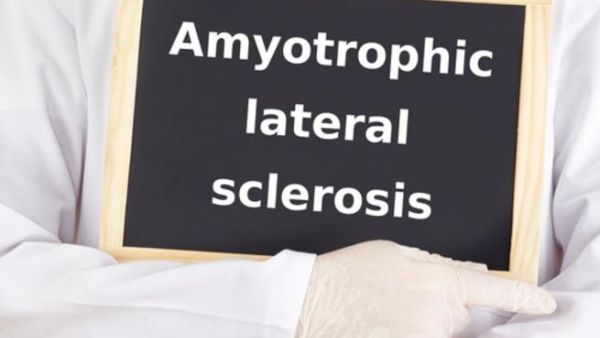 التصلب الجانبي الضموري هو شكل من أشكال أمراض الأعصاب الحركيّة