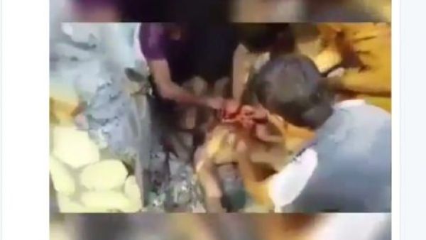 تمزيق جسد سني عراقي واكل لحمه