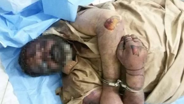 جثة أحد الفارين من الفلوجة قتل تحت تعذيب مليشيات الحشد الشعبي- فيسبوك