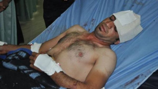 Iraqi wounded