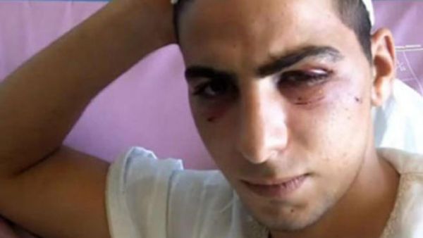 الحدث القلالوة في المستشفى/عن موقع خبرني الادني