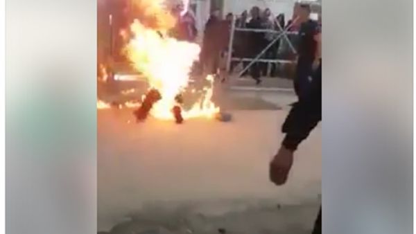 يعاني الشاب من حالة سيئة حرجة للغاية بسبب الحروق الشديدة التي تعرض لها