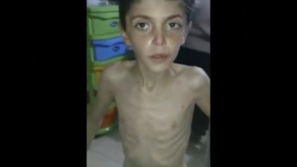 “مشاهد مفجعة” للجوعى في بلدة مضايا