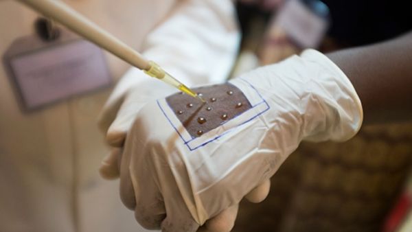 مصر تشهد أول حالة وفاة بـ"الملاريا" منذ سنوات