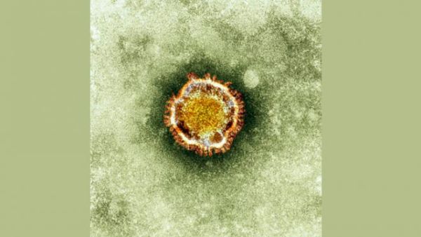 An electron image of the nCoV virus. 