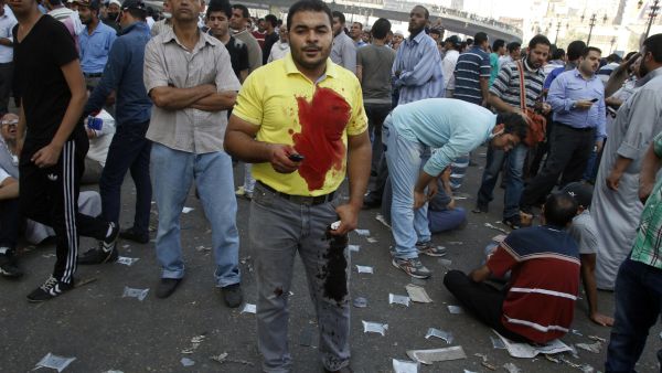 A supporter of the Muslim Brotherhood and Egypt's ousted president Mohamed Morsi stands in a blood-stained shirt as demonstrators gather in Cairo's Abbassiya neighbourhood (AFP/MOHAMMED ABDEL MONEIM)