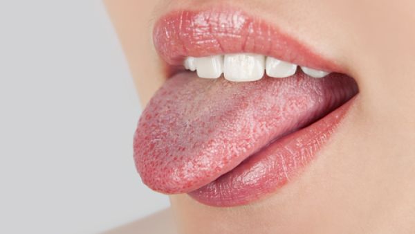 التهاب اللسان: الأسباب والأعراض