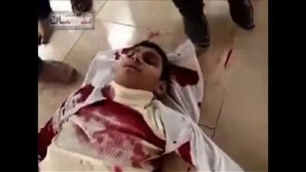 صورة ارشيفية لاحد المصابين برصاص الامن في مدينة درعا جنوب سوريا