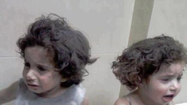 اطفال ناجين من مجزرة دوما 