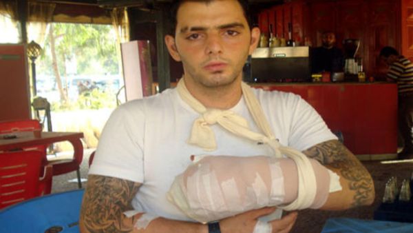 Ehab Al Azzi had his fingers chopped off by religious extremists on Sunday (Photo courtesy of annahar.com) 