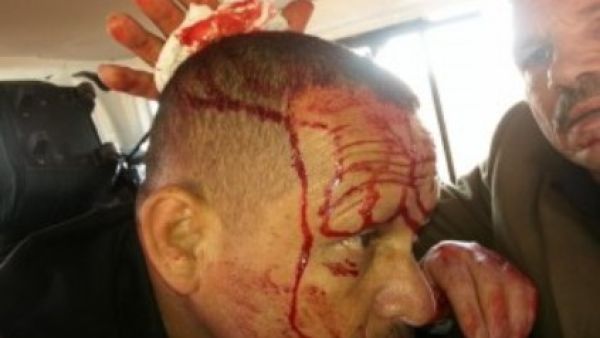 اصابة خمسة اردنيين مؤيدين للنظام السوري في هجوم على حافلتهم في سوريا
