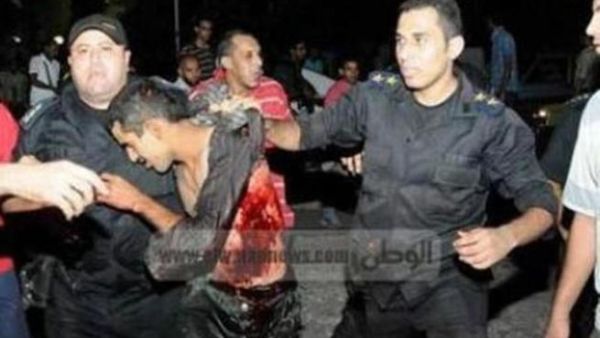 Alleged Crucifixion Victim