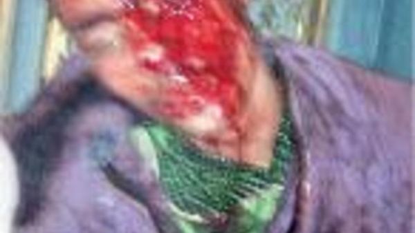 'Victim of torture at presidential palace' (Photo: Mohamed El-Garhi)