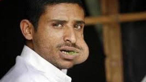 Qat is both the bane and the boon of the troubled country, Yemen.