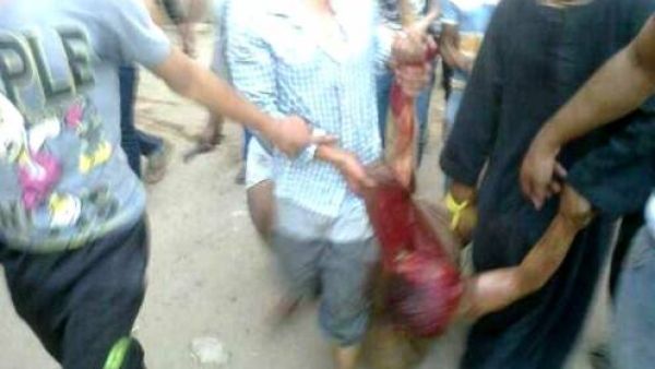 صورة نشرتها مواقع اخبارية مصرية لما تقول انها احد الشيعة الذين تم قتلهم وسجلهم على يد القرويين في الجيزة