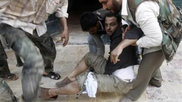 مقاتل من الجيش الحر أصيب خلال معارك مع قوات الأسد في حلب