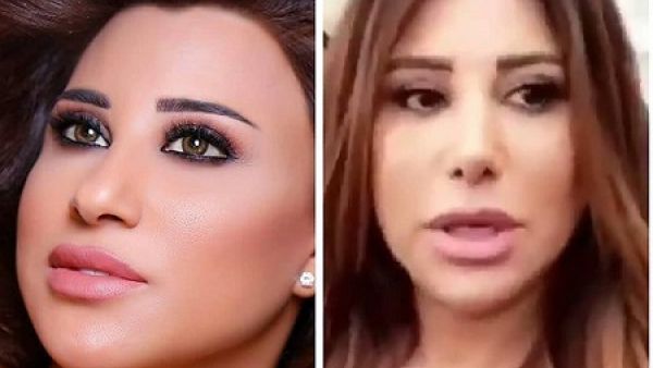 نجوى كرم تكشف عن السبب الحقيقي لتجميل أنفها