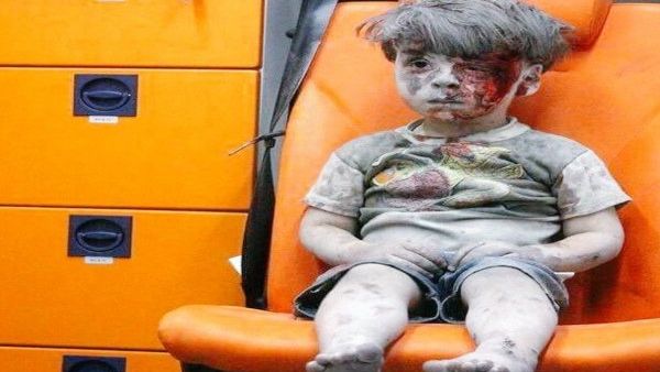 شاهدوا الطفل عمران بعد أن تحسنت صحته (صور)
 شاهدوا الطفل عمران بعد أن تحسنت صحته (صور)