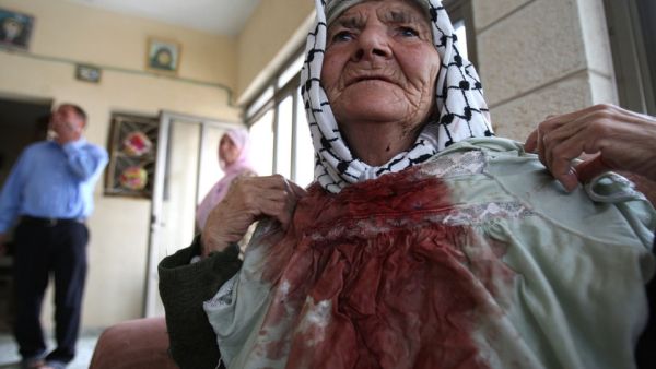 A Palestinian woman displays her dress, stained with blood after Israeli settlers attacked her with a stone while she was harvesting olives on October 31, 2011.  (AFP/Abbas Momani)