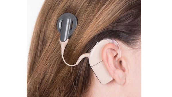 Cochlear implants are devices that can provide sound for people who receive little or no benefit from hearing aids. 