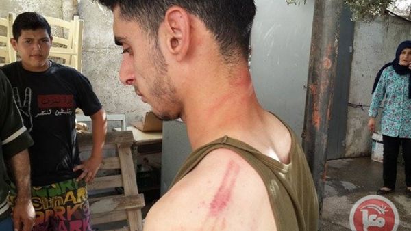 صورة الفتى الذي تعرض للاعتداء