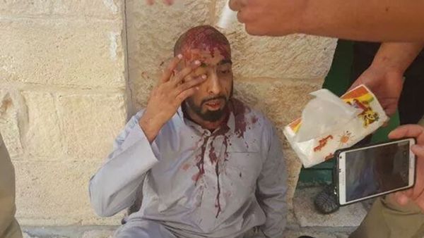 أحد المعتكفين ينزف بعد اعتداء قوات الاحتلال عليه 