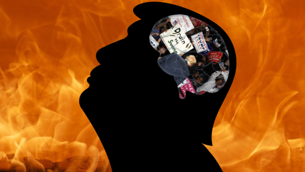 Trump's brain, Al Bawaba