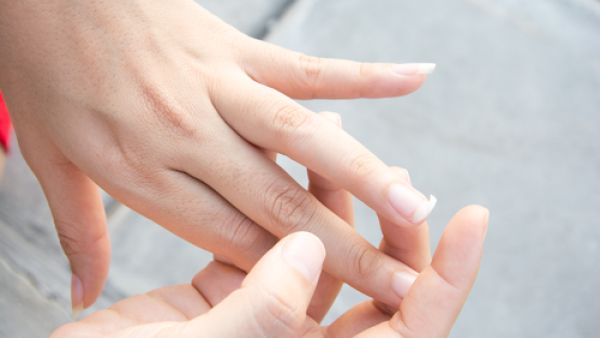 يرجع تقصف الأظافر إل التعرض للماء كثيرا
