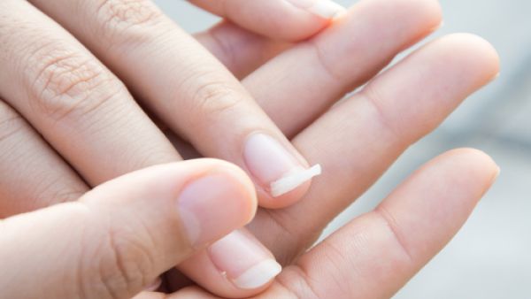 تعرض الأظافر للماء و الصابون أو المنظفات لفترات طويلة يؤدي إلى ضعفها 