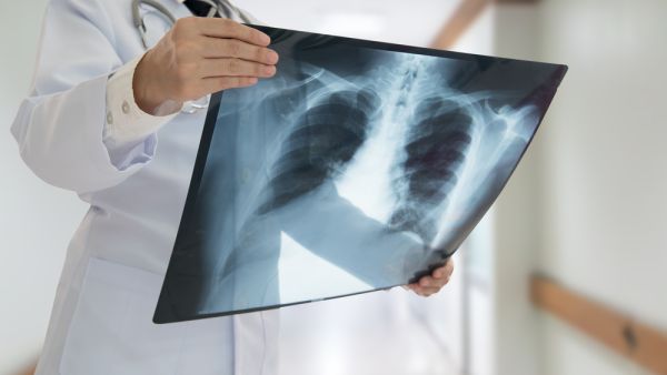 It was during a chest CT scan that the cause of her symptoms came to light (Shutterstock/File)