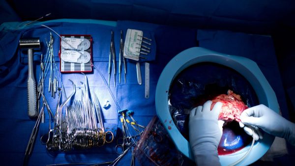 Desperate Egyptians are being forced to sell their organs (AFP)