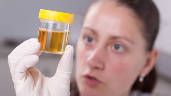 Urine trouble now! (Shutterstock)