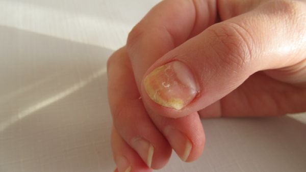 لتبييض الأظافر انقعيهم بيكربونات الصودا مع كوب من الماء الفاتر 