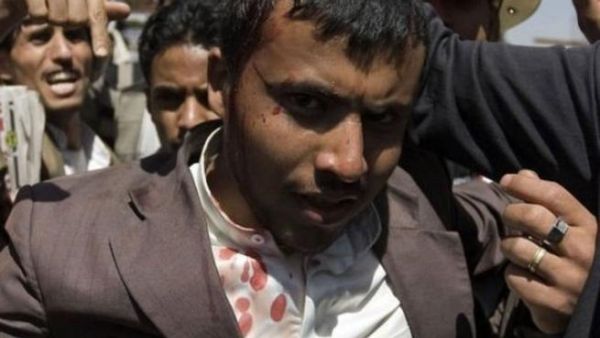 Yemeni wounded