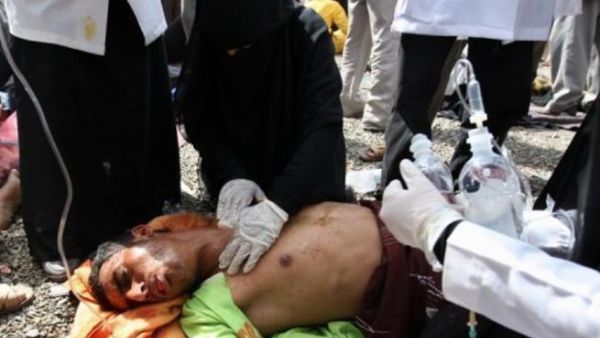 Yemeni wounded