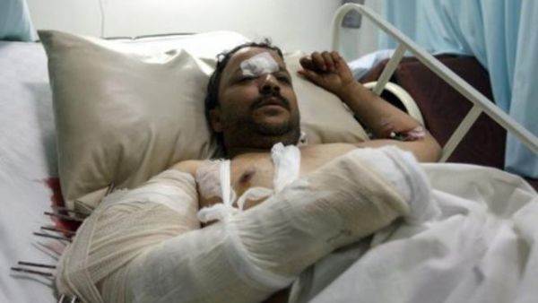 Yemen clashes