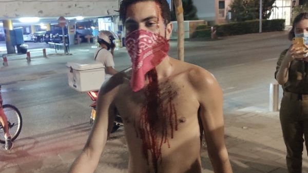 "بلطجية" نتانياهو يهاجمون تظاهرة معارضة له في تل أبيب 