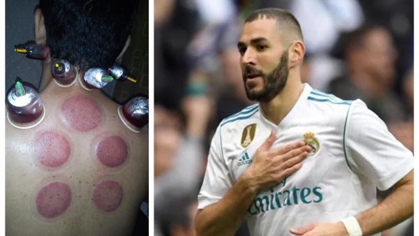 كريم بنزيما 