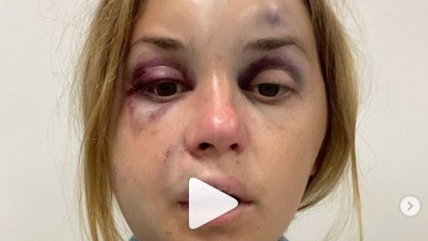 مذيعة تلفزيون أوكرانية تتعرض للضرب ومحاولة اغتصاب أمام ابنها