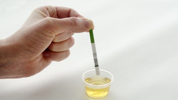 هل يظهر الحمل في تحليل البول قبل موعد الدورة بيومين هل يظهر الحمل في تحليل البول قبل موعد الدورة بيومين