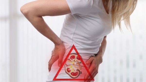 أفضل طريقة لمنع تشكل حصوات الكلى هي شرب الكثير من الماء