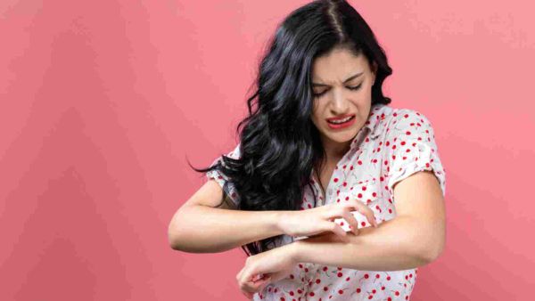 يعدّ مرض الأكزيما مرضاً قابلاً للعلاج