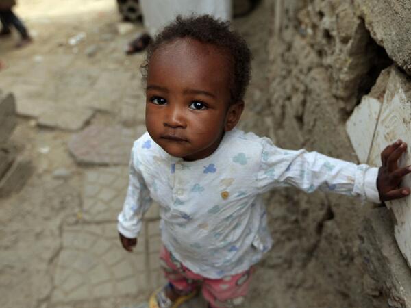 A child of Yemen's minority group known as "Muhamasheen" -- literally the "Marginalised" is pictured at a slum in the capital Sanaa on July 4, 2020. At a time when the Black Lives Matter movement is reshaping societies, black Yemenis have scant hope for an end to centuries of discrimination that has only worsened during the civil war. In Sanaa, members of the minority group known as "Muhamasheen" live in dismal conditions in densely populated slums. They count among the poorest of the poor in the Arab world
